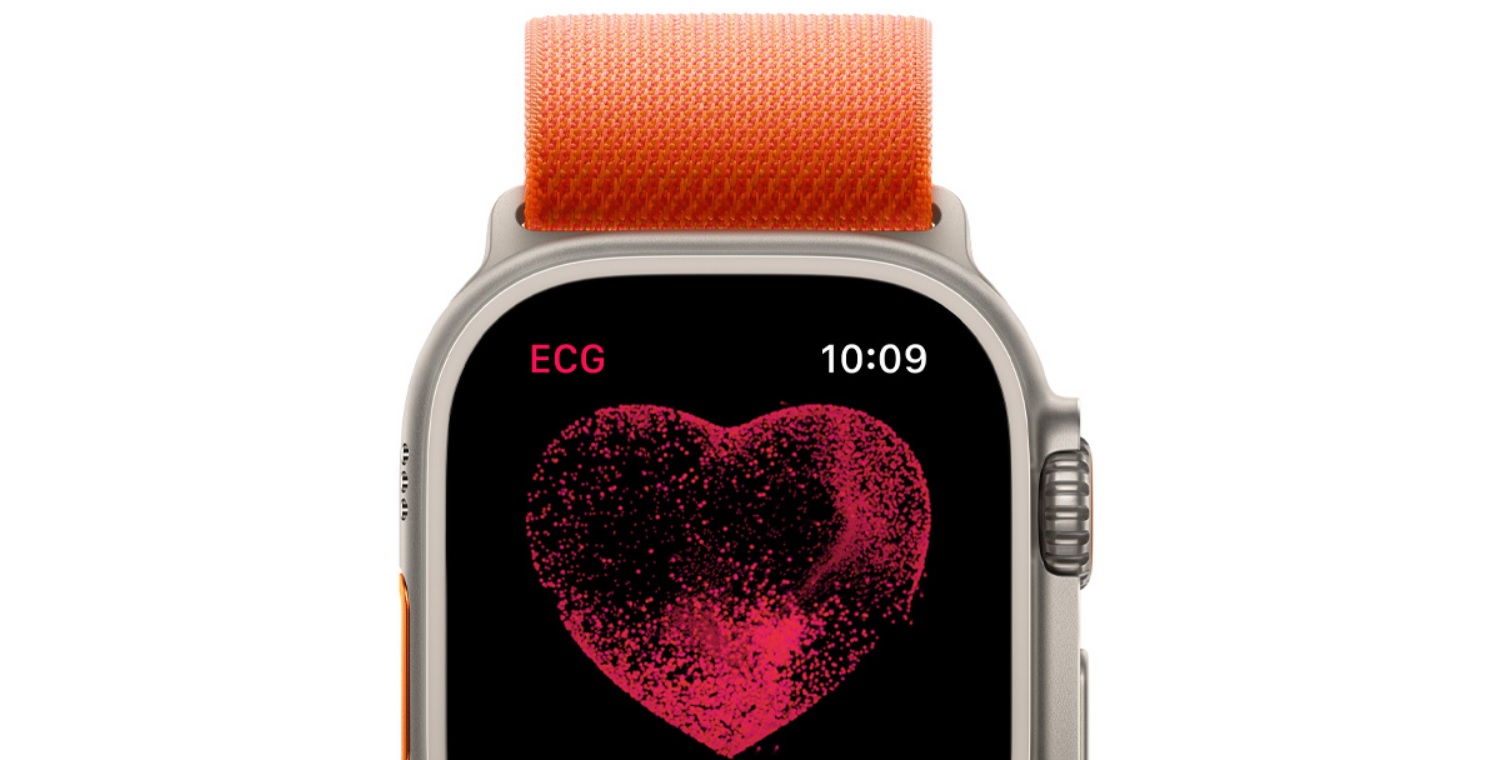 Chytré hodinky APPLE Watch Ultra GPS + Cellular 49mm Titanium Case with Green Alpine Loop  Large